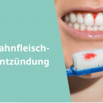 Mundspülung für weiße zähne - Die hochwertigsten Mundspülung für weiße zähne im Vergleich!
