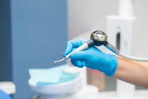 Zahnstein vorbeugen mit professioneller Zahnreinigung